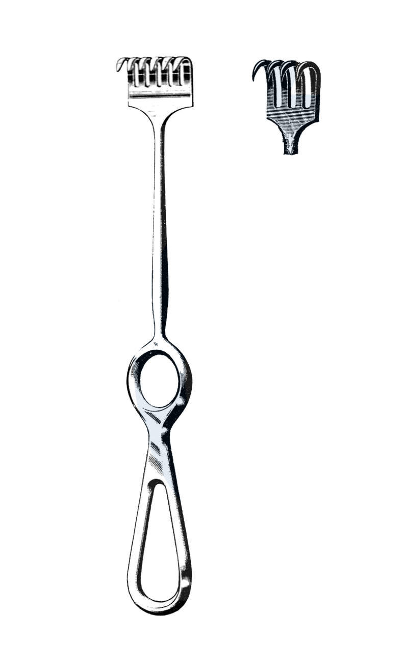 Sharp prongs on ring deals